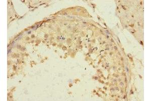 Immunohistochemistry of paraffin-embedded human testis tissue using ABIN7172192 at dilution of 1:100 (TIGD4 抗体  (AA 301-512))