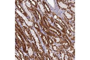 Immunohistochemical staining of human kidney with PRDM12 polyclonal antibody  shows strong cytoplasmic positivity in cells in tubules at 1:10-1:20 dilution. (PRDM12 抗体)