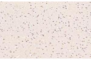 Immunohistochemistry (Paraffin-embedded Sections) (IHC (p)) image for anti-Zinc Finger Protein 746 (ZNF746) antibody (ABIN7076272)