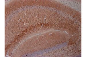 Indirect immunostaining of a PFA fixed mouse hippocampus section with rabbit anti-MAP 2.
