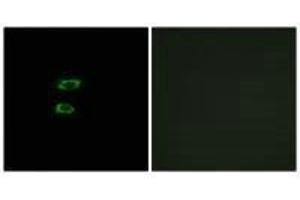 Immunofluorescence analysis of A549 cells, using BMP8A antibody. (BMP8A 抗体  (C-Term))