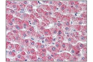 Immunohistochemistry: GPR126 antibody staining of Formalin-Fixed, Paraffin-Embedded Human Liver. (G Protein-Coupled Receptor 126 抗体  (N-Term))