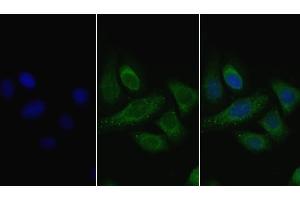 Detection of LPL in Human Hela cell using Polyclonal Antibody to Lipoprotein lipase (LPL) (Lipoprotein Lipase 抗体  (AA 28-474))