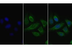 Detection of LPL in Human Hela cell using Polyclonal Antibody to Lipoprotein lipase (LPL) (Lipoprotein Lipase 抗体  (AA 28-474))