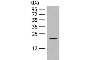 Western blot analysis of Rat heart tissue lysate using CLEC3B Polyclonal Antibody at dilution of 1:650 (CLEC3B 抗体)