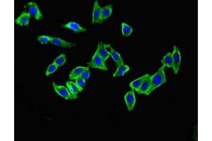 Immunofluorescent analysis of HepG2 cells using ABIN7159432 at dilution of 1:100 and Alexa Fluor 488-congugated AffiniPure Goat Anti-Rabbit IgG(H+L) (Metabotropic Glutamate Receptor 1 抗体  (AA 880-1017))