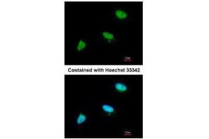 ICC/IF Image Immunofluorescence analysis of paraformaldehyde-fixed A549, using CDC34, antibody at 1:200 dilution. (CDC34 抗体)