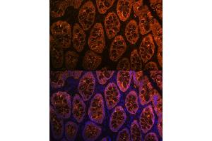 Immunofluorescence (IF) image for anti-Galectin 4 (LGALS4) antibody (ABIN1679347)