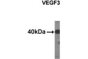 Western Blotting (WB) image for anti-Vascular Endothelial Growth Factor C (VEGFC) antibody (ABIN2995286) (VEGFC 抗体)