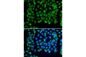 Immunofluorescence analysis of MCF-7 cells using RNF8 antibody (ABIN5974404). (RNF8 抗体)