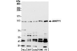 anti-Ankyrin Repeat and FYVE Domain Containing 1 (ANKFY1) (AA 1-50) antibody
