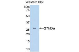Western blot analysis of the recombinant protein. (Clusterin 抗体  (AA 227-447))
