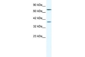 WB Suggested Anti-ZNF660 Antibody Titration:  1. (ZNF660 抗体  (C-Term))