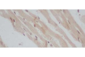 Immunohistochemistry of paraffin-embedded Mouse heart using ERG Polyclonal Antibody at dilution of 1:50 (ERG 抗体)
