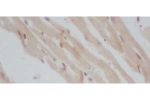 Immunohistochemistry of paraffin-embedded Mouse heart using ERG Polyclonal Antibody at dilution of 1:50 (ERG 抗体)