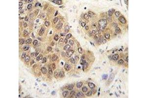 Immunohistochemistry (IHC) image for anti-Small Ubiquitin Related Modifier 4 (SUMO4) (AA 34-63), (Wild Type) antibody (ABIN3032654)