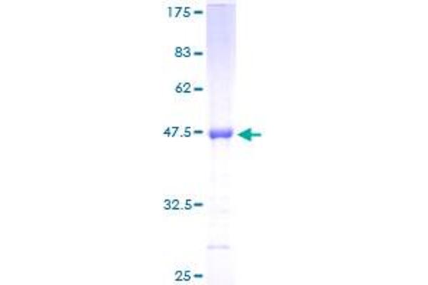 TIMP2 Protein (AA 27-220) (GST tag)