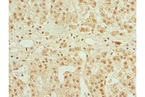 Immunohistochemistry of paraffin-embedded human adrenal gland tissue using ABIN7148657 at dilution of 1:100 (CFDP1 抗体  (AA 1-299))