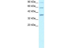 WB Suggested Anti-PAWR Antibody Titration:  0. (PAWR 抗体  (Middle Region))