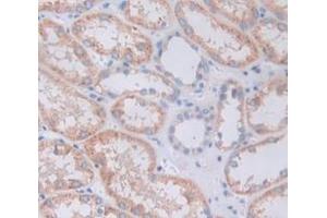 IHC-P analysis of Human Tissue, with DAB staining. (GDF3 抗体  (AA 251-364))