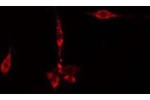 ABIN6275616 staining  CoLo205 cells by IF/ICC. (SYT11 抗体  (Internal Region))