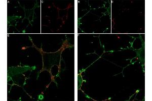 Live cell imaging of GsMTx-4-ATTO Fluor-647N in differentiated  cells. (GsMTx-4 peptide (Atto 647N))