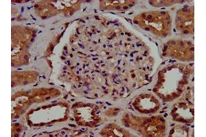 Immunohistochemistry (IHC) image for anti-Core 1 Synthase, Glycoprotein-N-Acetylgalactosamine 3-beta-Galactosyltransferase, 1 (C1GALT1) (AA 34-143) antibody (ABIN7154230)
