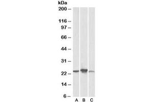 Western blot testing of human [A], mouse [B], rat [C] liver lysate with ABHD14B antibody at 0. (ABHD14B 抗体)