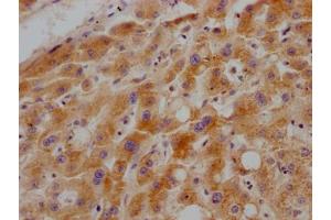 IHC image of ABIN7127528 diluted at 1:100 and staining in paraffin-embedded human liver tissue performed on a Leica BondTM system. (Recombinant Growth Hormone Receptor 抗体)