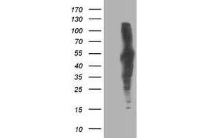 Western Blotting (WB) image for anti-Dihydrolipoamide Dehydrogenase (DLD) antibody (ABIN1497845) (DLD 抗体)