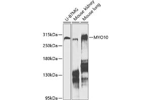 Western blot analysis of extracts of various cell lines, using MYO10 antibody (ABIN6128319, ABIN6144271, ABIN6144274 and ABIN6216113) at 1:1000 dilution. (Myosin X 抗体  (AA 845-944))