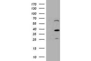 Western Blotting (WB) image for anti-Dystrobrevin, beta (DTNB) antibody (ABIN1497914) (Dystrobrevin beta 抗体)