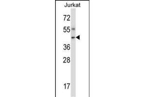 Mouse Nim1 Antibody (C-term) (ABIN657849 and ABIN2846810) western blot analysis in Jurkat cell line lysates (35 μg/lane). (NIM1 抗体  (C-Term))