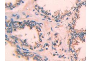 Used in DAB staining on fromalin fixed paraffin- embedded rectum cancer tissue (ECT2 抗体  (AA 166-348))
