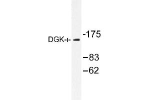 Image no. 1 for anti-Diacylglycerol Kinase, iota (DGKI) antibody (ABIN272146) (DGKI 抗体)