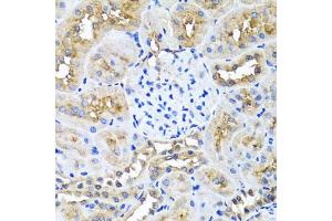 Immunohistochemistry of paraffin-embedded rat kidney using NIN antibody (ABIN5974918) at dilution of 1/100 (40x lens). (Ninein 抗体)