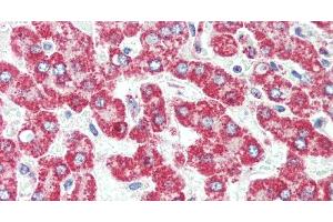 Immunohistochemistry (Paraffin-embedded Sections) (IHC (p)) image for anti-Hydroxysteroid (17-Beta) Dehydrogenase 8 (HSD17B8) antibody (ABIN7237190)