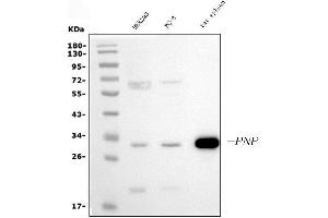 Western blot analysis of PNP using anti-PNP antibody (ABIN7602996).