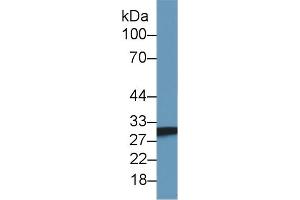 Detection of SDHB in Mouse Skeletal muscle lysate using Polyclonal Antibody to Succinate Dehydrogenase Complex Subunit B (SDHB) (SDHB 抗体  (AA 97-282))
