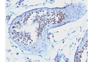 Formalin-fixed, paraffin-embedded human testicular carcinoma stained with Cyclin B1 antibody. (Cyclin B1 抗体)
