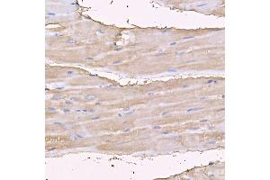 Immunohistochemistry of paraffin-embedded rat heart using MYH4 antibody (ABIN7268749) at dilution of 1:150 (40x lens). (MYH4 抗体  (AA 1450-1550))