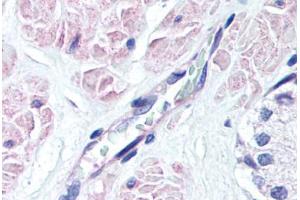 Human Prostate, Vessel (formalin-fixed, paraffin-embedded) stained with S1PR3 antibody ABIN337001 at 10 ug/ml followed by biotinylated goat anti-rabbit IgG secondary antibody ABIN481713, alkaline phosphatase-streptavidin and chromogen. (S1PR3 抗体  (AA 12-25))