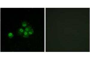 Immunofluorescence analysis of MCF7 cells, using IRS-1 (Phospho-Ser636) Antibody. (IRS1 抗体  (pSer636))