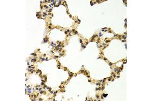 Immunohistochemistry of paraffin-embedded rat lung using DNMT3A Antibody (ABIN1872325) at dilution of 1:100 (40x lens). (DNMT3A 抗体)