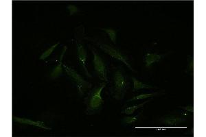 Immunofluorescence of monoclonal antibody to MEF2D on HeLa cell. (MEF2D 抗体  (AA 256-351))