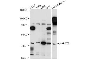 Western blot analysis of extracts of various cell lines, using AGPAT3 antibody (ABIN6291715) at 1:3000 dilution. (AGPAT3 抗体)