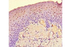 Immunohistochemistry of paraffin-embedded human tonsil tissue using ABIN7149800 at dilution of 1:100 (DET1 抗体  (AA 5-190))