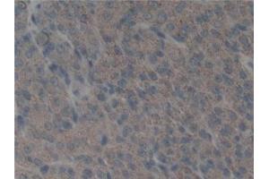Immunohistochemistry (IHC) image for anti-Plasminogen Activator, Urokinase (PLAU) (AA 180-433) antibody (ABIN7431170)