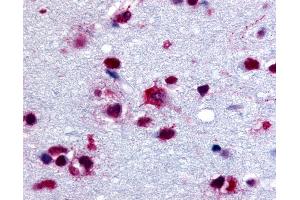 Anti-PYGB antibody IHC of human brain. (PYGB 抗体  (C-Term))