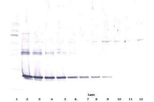Image no. 2 for anti-Ciliary Neurotrophic Factor (CNTF) antibody (ABIN465750) (CNTF 抗体)